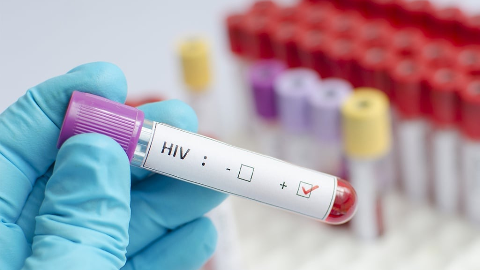 Contaminação por HIV após transplante de orgãos